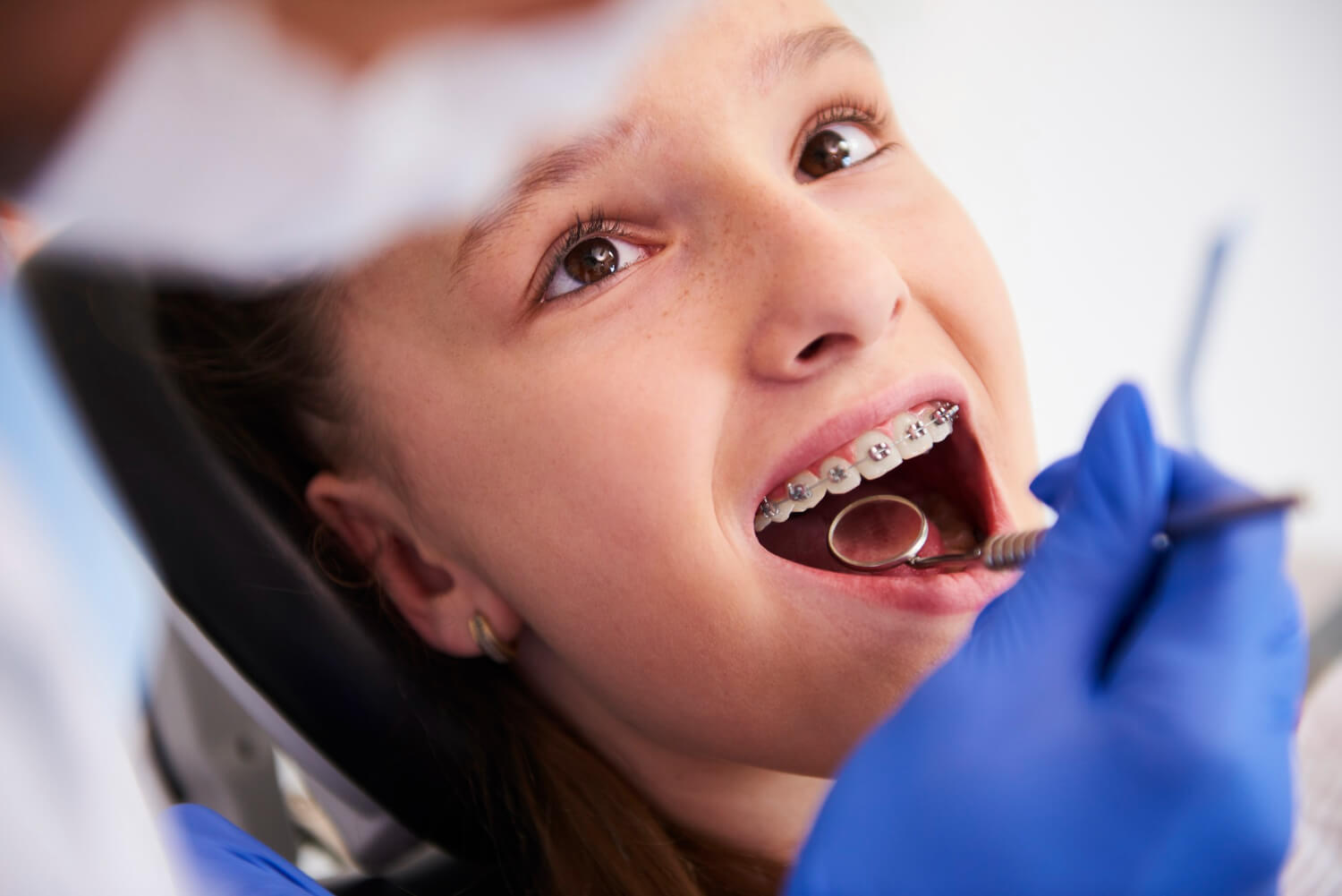Dentista que coloca aparelho em Barbacena